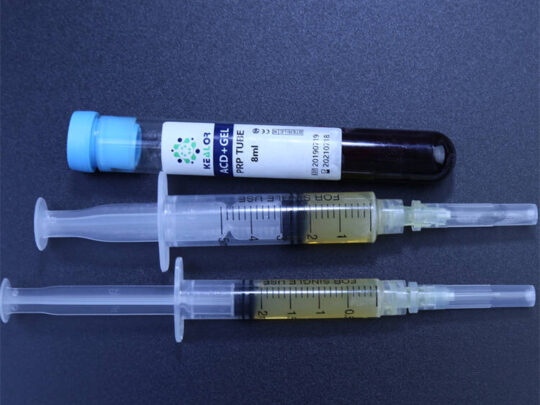 KEALOR platelet rich plasma prp tube with separating gel(acd gel, sodium citrate) with biotin ,ha ,activator prp for sale